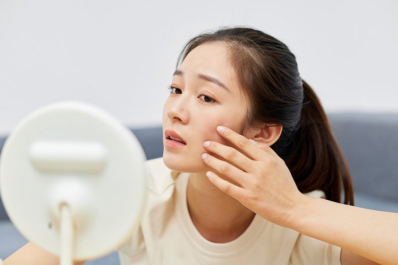 脸上长痘痘是因为什么原因引起的