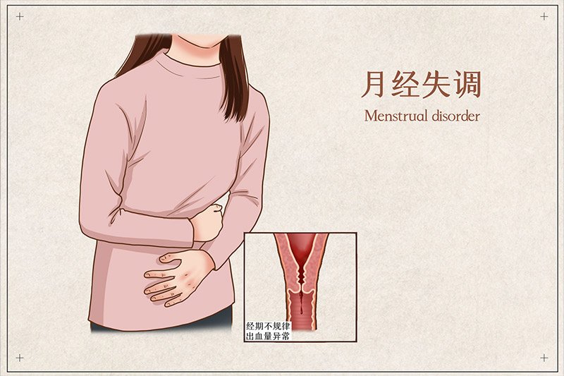 痛经主要是什么引起的